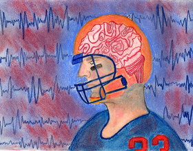 Tracking and handling concussions in college football is left to schools. Doctors think that should change.