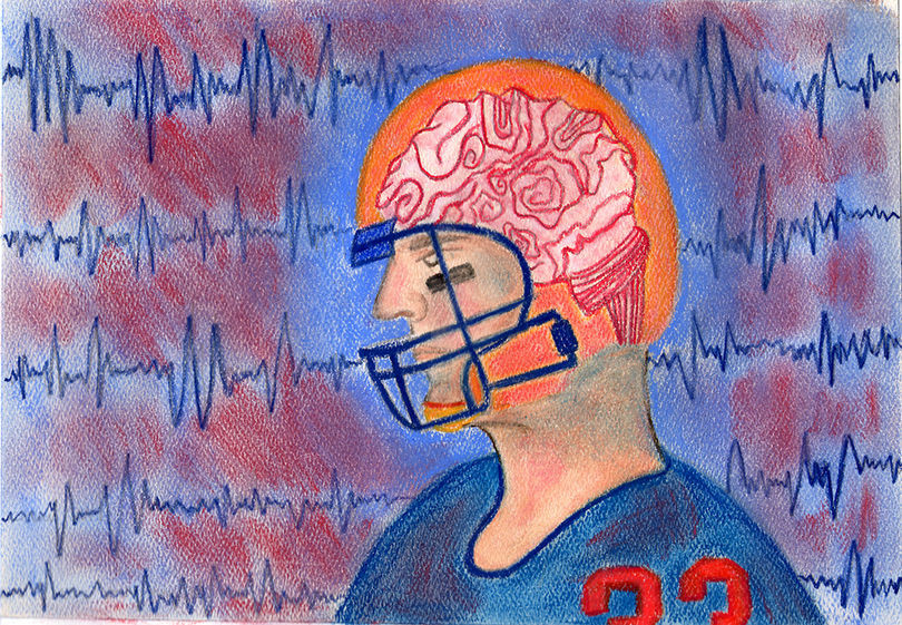 Tracking and handling concussions in college football is left to schools. Doctors think that should change.